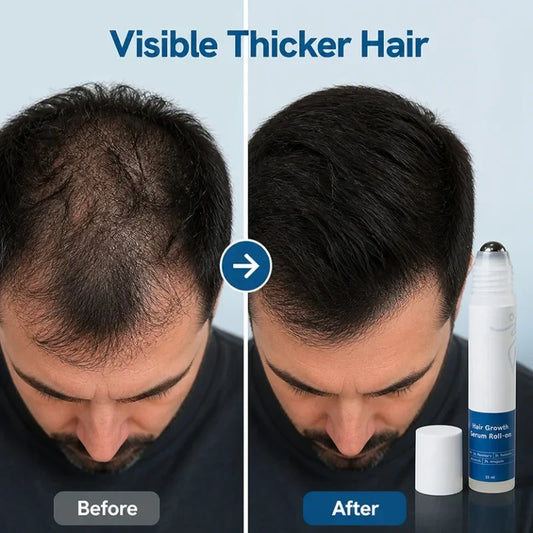 TressForce™ — Ignite Bold, Thick Hair That Commands Attention
