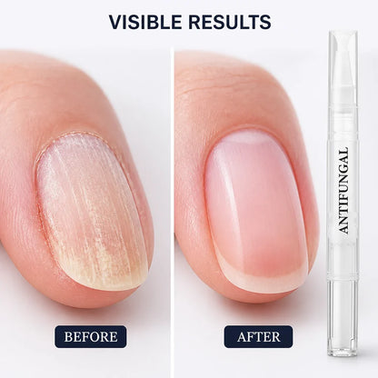 TipMuse™ — Transform Your Nails into Strong, Radiant Confidence Boosters