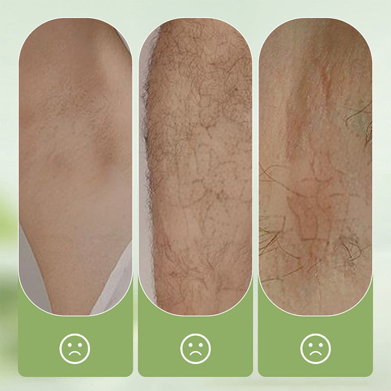 SilkEase™ Hair Removal Cream
