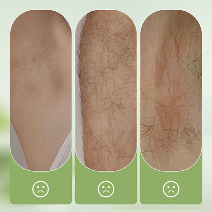 SilkEase™ Hair Removal Cream