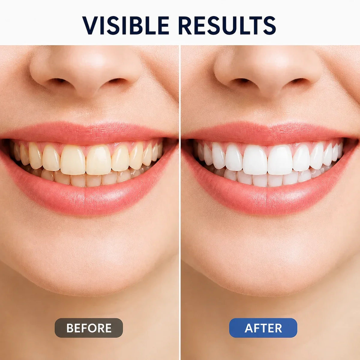 SmileLustre™ Whitening Serum — Reveal a Brilliant Smile That Lights Up Every Room