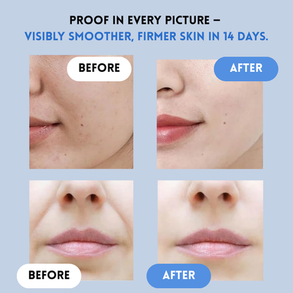 YouthLift Renew Strips – The Instant Solution for Timeless Beauty + 50% OFF