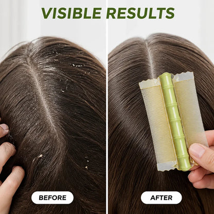 Calmora™— End Itch & Tangles for Smooth, Happy Scalp Freedom
