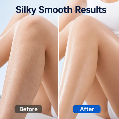 Cryonelle™ — Experience Pain-Free, Ice-Cool Smoothness That Lasts for Days