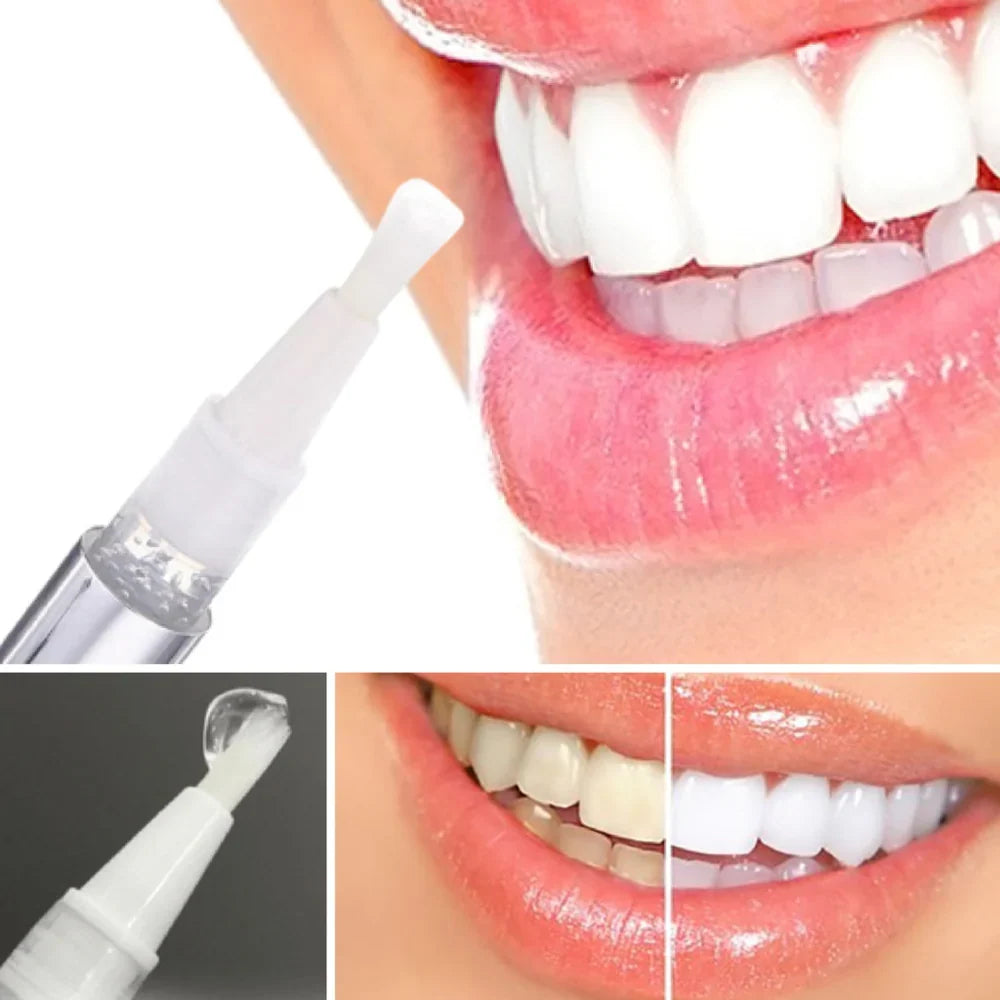 Teeth Whitening Pen - Radiant smile in 10 minutes