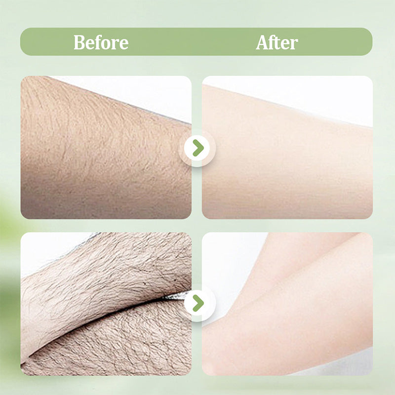 SilkEase™ Hair Removal Cream
