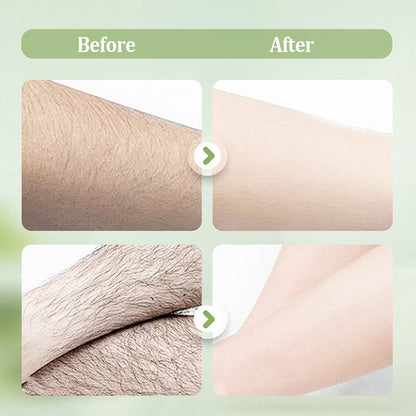 SilkEase™ Hair Removal Cream