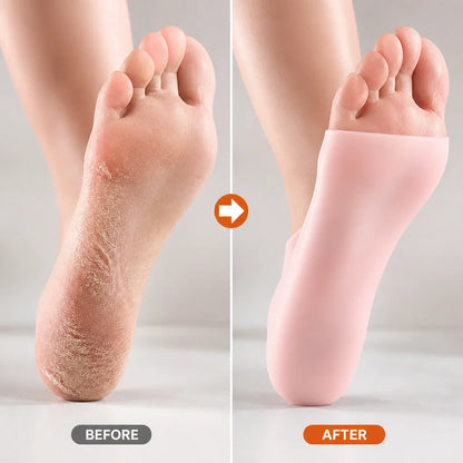 Solevia™ — Turn Your Feet into a Silky-Soft Sanctuary You’ll Love to Show Off