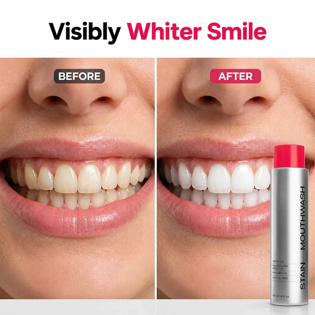 IvorySpark™ — Unleash a Brilliant Smile That Commands Every Room