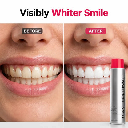 IvorySpark™ — Unleash a Brilliant Smile That Commands Every Room